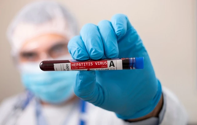 Žloutenka typu C je stále problémem, přibývá i&nbsp;hepatitida typu E